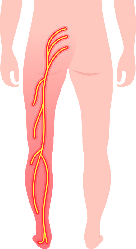 spinal bone disk nerve broken curves poor hunched over back dowager’s  pain injury spine density test lumbar disc Piriformis syndrome pinched radiculopathy sacroiliac joint sacroiliitis